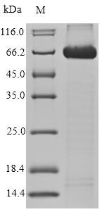 Human ALCAM protein