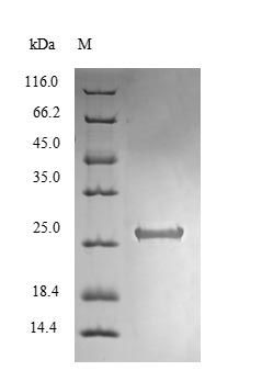 Bacterial RELG protein