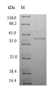 Human UL130 protein
