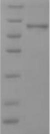 Human SPRR2B protein