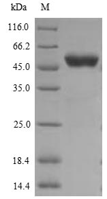 Human CCNB1 protein