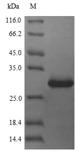 Human CDKN3 protein