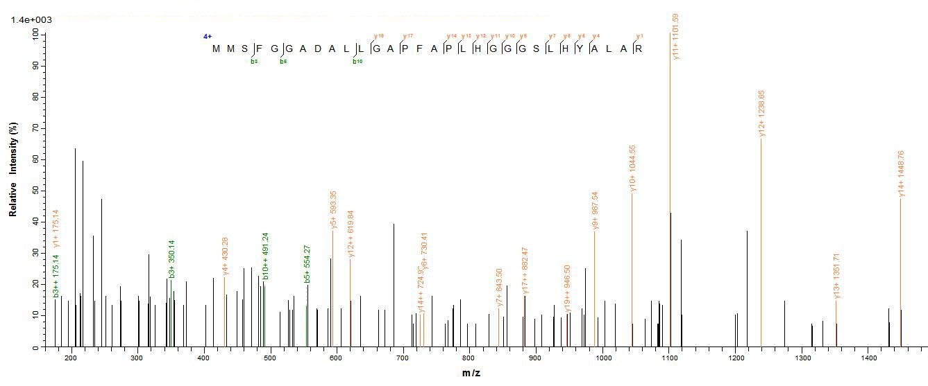 Human NEFH protein
