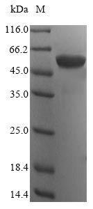 Human ATP5A1 protein