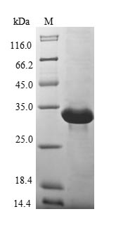 Human MT3 protein