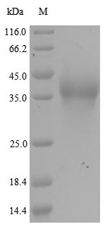Human RANBP2 protein