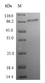 Human ACSS1 protein