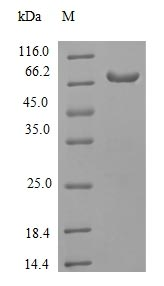 Human RIPK3 protein