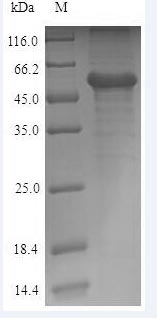 Human CALR protein
