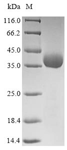 Human Outer capsid protein VP4 protein