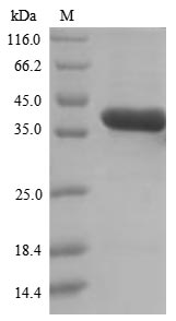 Mouse QPCT protein