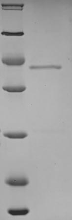 Human SLC8A1 protein