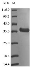 Bacterial RV1984C protein