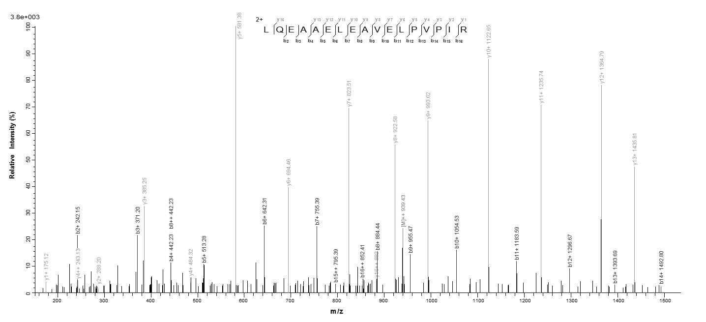 Human SLC4A1 protein