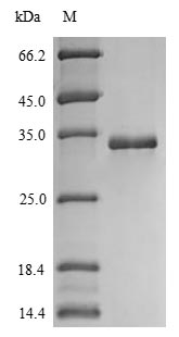Human S100A14 protein