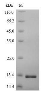 Human CACNA2D1 protein