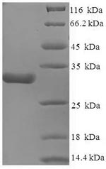 Human CACNA2D1 protein