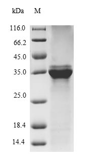 Bovine S100A9 protein