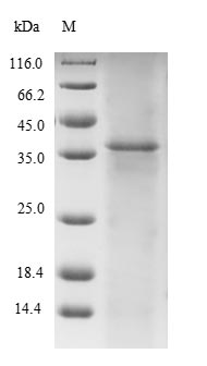 Human TTN protein