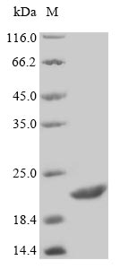 Human STATH protein