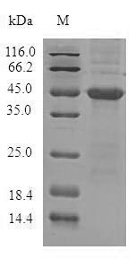 Human ADTRP protein