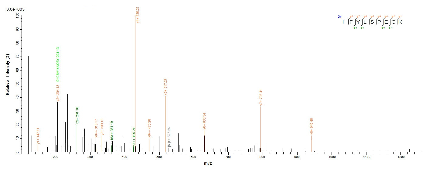 Human SLFN12L protein