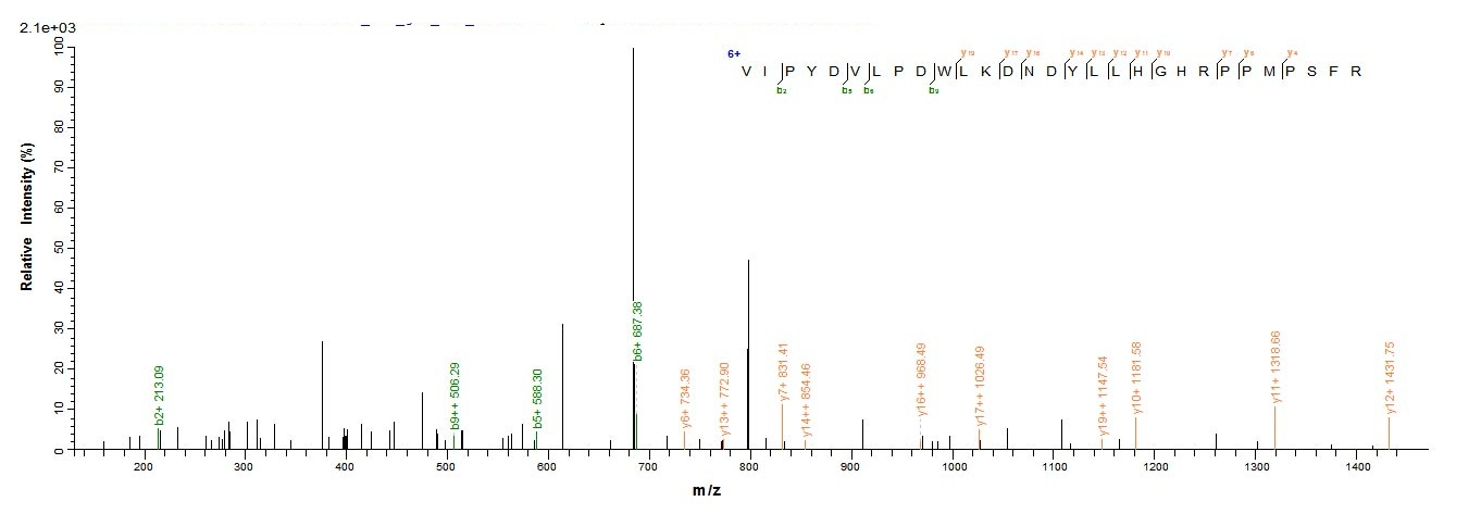 Human ADIPOR1 protein