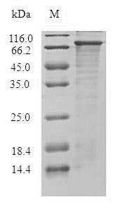 Human DGKE protein