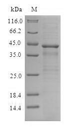 Human CXCR4 protein