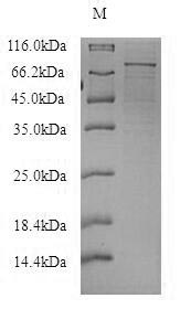 Human REXO4 protein