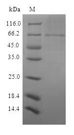 Viral Structural poly protein
