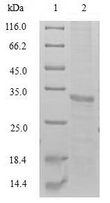 Human PRSS21 protein