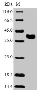 Viral VP35 protein