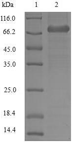Human LCP1 protein