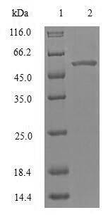 Human PARK2 protein