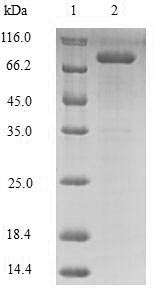 Human LOX protein
