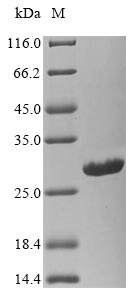Viral Nucleoprotein protein