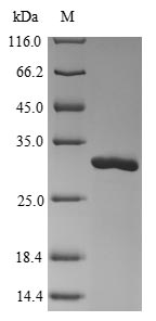 Viral Nucleoprotein protein