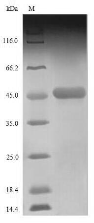 Viral Nucleoprotein protein
