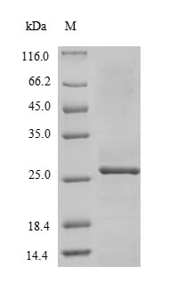 Viral RNA-directed RNA polymerase L protein