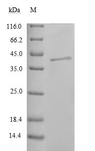 Viral Nucleoprotein protein