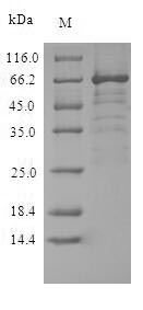 Viral Glycoprotein G protein