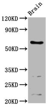 ASIC1 Antibody