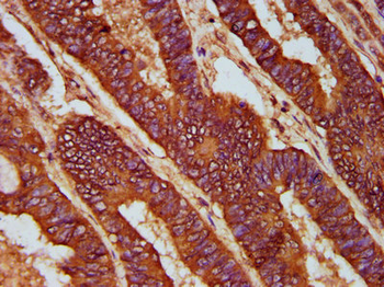 CD2AP Antibody