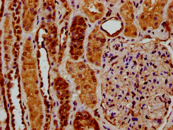 RYK Antibody