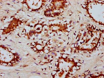 RYK Antibody