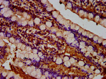 TUSC3 Antibody