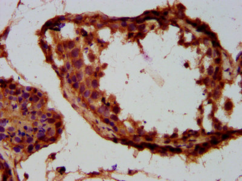 TUSC3 Antibody
