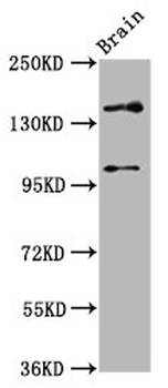 SOS1 Antibody