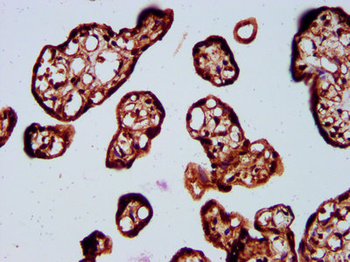 SOS1 Antibody